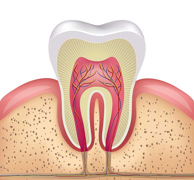 Пульпит - причина невыносимой зубной боли